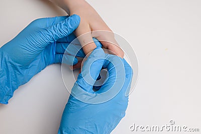 Doctor holds child hand with warts on thumb. Papillomavirus in child, close-up. Verruca vulgaris. HPV. Pediatric Stock Photo