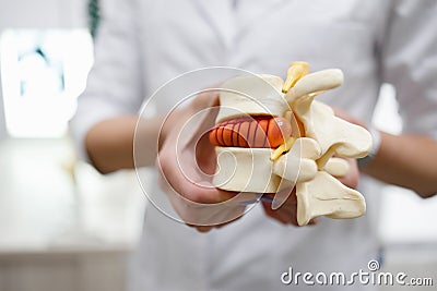 The doctor holds in his hands a model of a herniated lumbar disc of the spine. Stock Photo