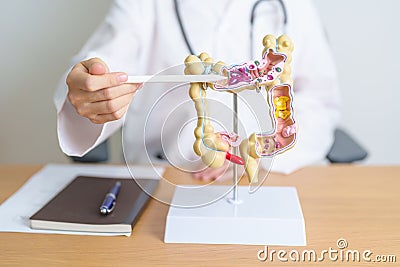 Doctor with human Colon anatomy model. Colonic disease, Large Intestine, Colorectal cancer, Ulcerative colitis, Diverticulitis, Stock Photo