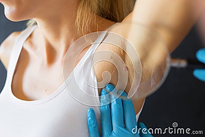 Doctor inspecting birthmarks on patient Stock Photo