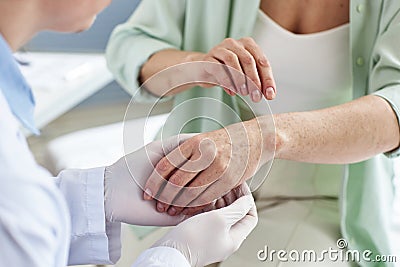Doctor inspecting skin rash on hand of female patient in dermatology clinic Stock Photo