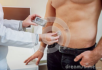 Doctor with an insulin pump connected in patient abdomen Stock Photo