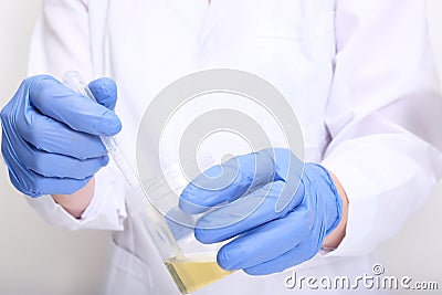 A doctor, lab technician in blue gloves holding urine sample in a plastic container, urinalysis and filling the pipette with urine Stock Photo