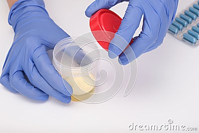 A doctor, lab technician opening urine sample in a plastic container, urinalysis on white background, medical check-up concept Stock Photo