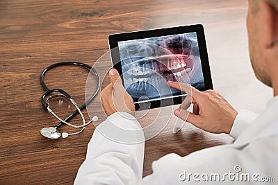 Doctor looking at human teeth x-ray Stock Photo