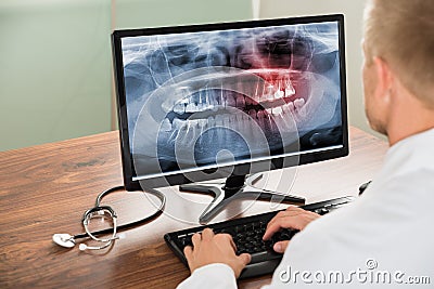 Doctor looking at teeth x-ray on computer Stock Photo