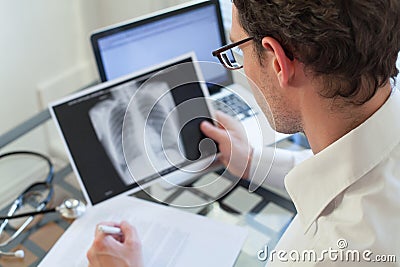 Doctor looking at x-ray of lungs, cancer diagnosis Stock Photo