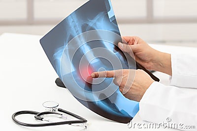 doctor looking at x-ray radiograph Stock Photo