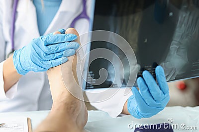 Doctor looking at xray of foot and examining patient leg closeup Stock Photo