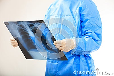 Doctor looking at xrays Stock Photo