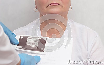 Doctor looks at results of an ultrasound scan of an adult woman`s thyroid gland, endocrine system disturbance, close-up Stock Photo
