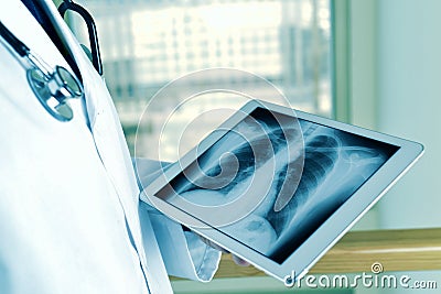 Doctor observing a chest radiograph in a tablet Stock Photo