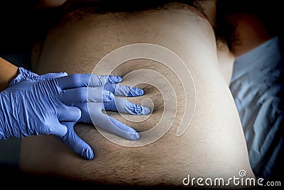 Doctor preparing abdominal palpation in a hospital Stock Photo