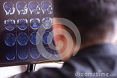 Doctor radiologist in hospital looking at mri x-ray scan of brain, head and skull ct scanning image on computer screen Stock Photo