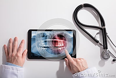 Doctor`s Hand And Digital Tablet Screen Showing Teeth X-ray Stock Photo