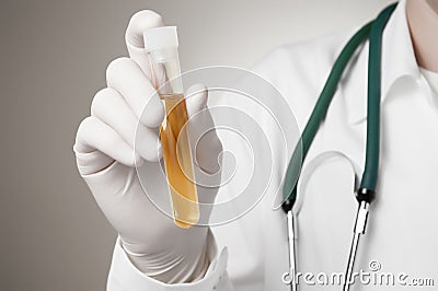 Doctor's hand with urine sample Stock Photo