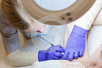 Doctor`s work on electrolysis with tweezers and an electrode, he removes unwanted hairs Stock Photo