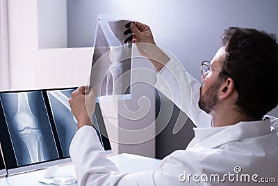 Doctor Screening Knee Bone X Ray Stock Photo