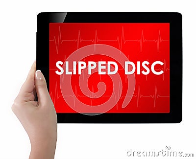 Doctor showing tablet with SLIPPED DISC text. Stock Photo