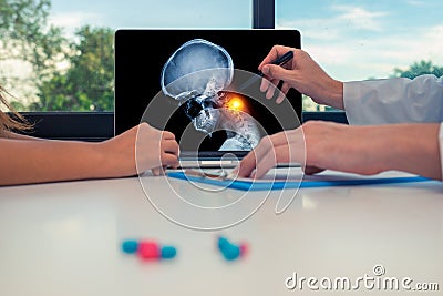 Doctor showing a x-ray of skull with pain in the neck on a laptop to a woman patient. Headache migraine or trauma concept Stock Photo