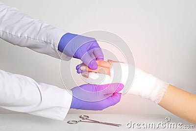 Doctor surgeon puts a splint on broken phalanges of fingers on a hand, close-up. Finger fracture with displacement, ankylosis, Stock Photo