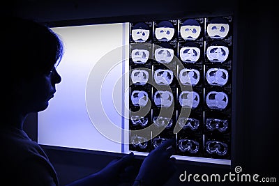 Doctor in surgical scrubs looking x-ray Stock Photo