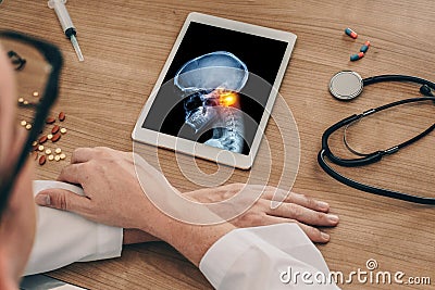 Doctor watching a digital tablet with x-ray of skull with pain in the top of the neck. Migraine headache or trauma concept Stock Photo