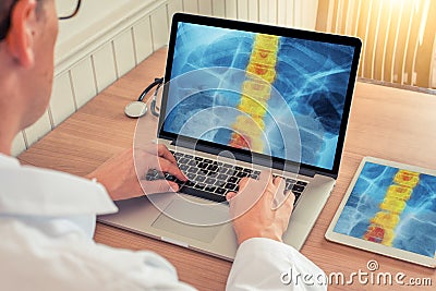 Doctor watching a laptop and digital tablet with x-ray of chest with pain relief on the spine in a medical office Stock Photo