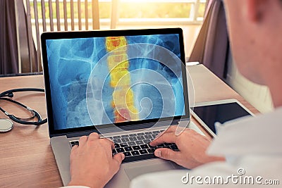 Doctor watching a x-ray of chest with pain in the spine. Radiology concept Stock Photo