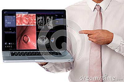 Doctor working with notebook showing CT colonography or CT Scan of Colon axial view vs Coronal view and 3D rendering image on the Stock Photo