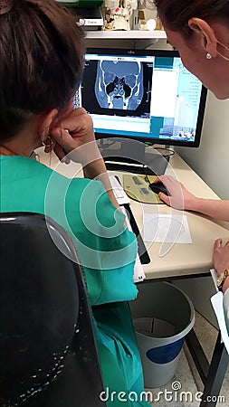 Doctors checking MRI on on the screen Editorial Stock Photo