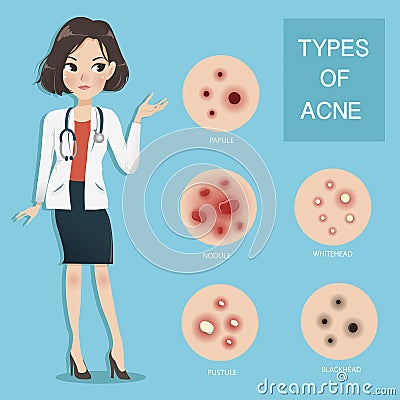 Doctors recommend typ of acne Vector Illustration