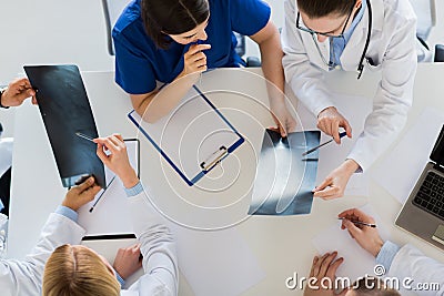 Doctors with spine x-rays and clipboards Stock Photo