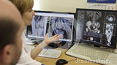 Dois doutores discutem os resultados do tomografia computorizada vídeos de arquivo Dois doutores discutem os resultados do tomografia computorizada vídeos de arquivo