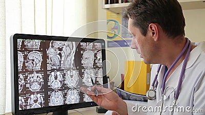 Doktor på bildskärmen med CT-bildläsning stock video Doktor på bildskärmen med CT-bildläsning stock video