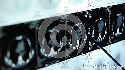 Doktorski nauki piersi ct obraz cyfrowy, medyczny promieniowanie rentgenowskie zdjęcie wideo Doktorski nauki piersi ct obraz cyfrowy, medyczny promieniowanie rentgenowskie zdjęcie wideo