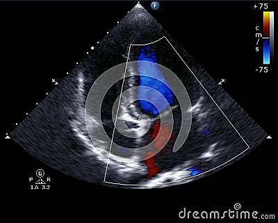 Doppler echocardiography Stock Photo