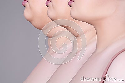 Double chin, skin rejuvenation on the neck, before after anti aging concept Stock Photo