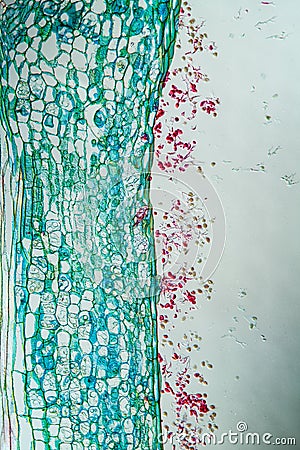 downy mildew on pastoral herb Stock Photo