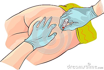 Drawing of Gloved hands aspirating syringe at dorsogluteal site of injection Vector Illustration