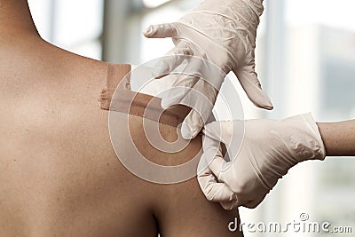 Dressing the wound Stock Photo