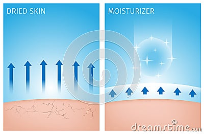 Dried skin and skin with moisturizer , before and after Stock Photo