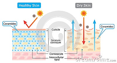 Dry and healthy skin layer illustration. skin care concept Vector Illustration