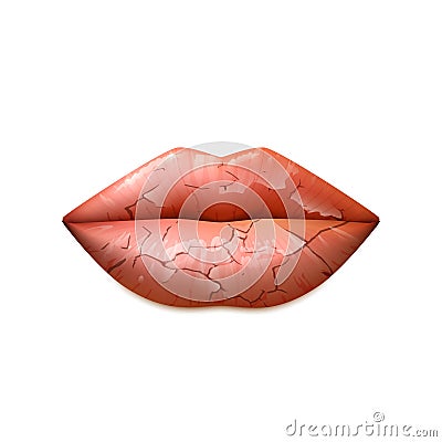 Dry Lips Illustration Vector Illustration