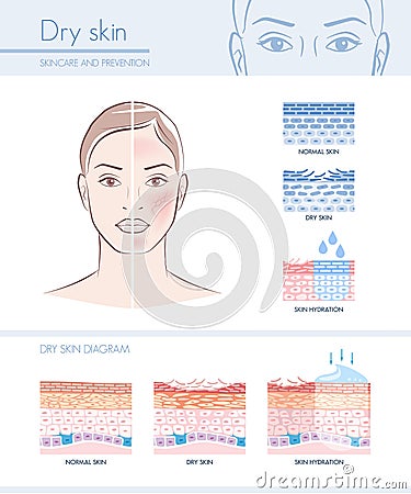 Dry skin Vector Illustration