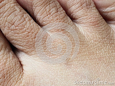 Dry and wrinkles skin of feet. Skin ages depend on many factors: aging, your lifestyle, diet, heredity, and other personal habits. Stock Photo