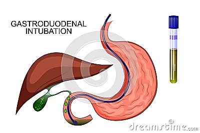 Duodenal sounding stomach, gaster, liver Vector Illustration