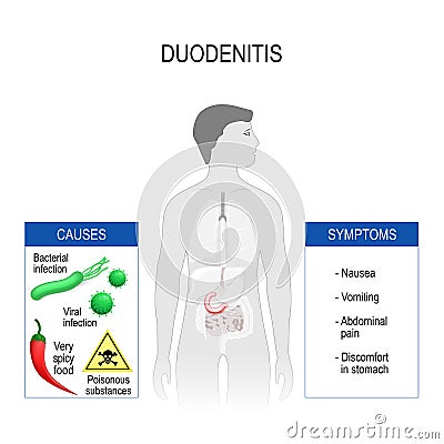 Duodenitis. Symptoms and causes. Vector Illustration