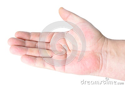 Dupuytren`s contracture, also called Dupuytren`s disease, Morbus Dupuytren, Viking disease, and Celtic hand. On white background Stock Photo