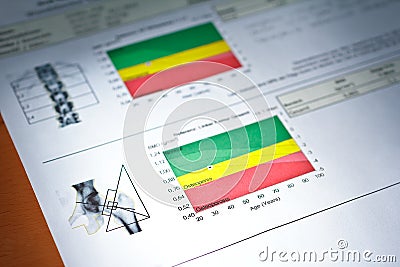 Dxa bone density scan osteoporosis prevention Stock Photo